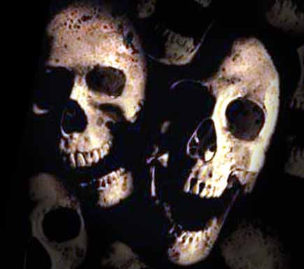 Burke and Hare skulls